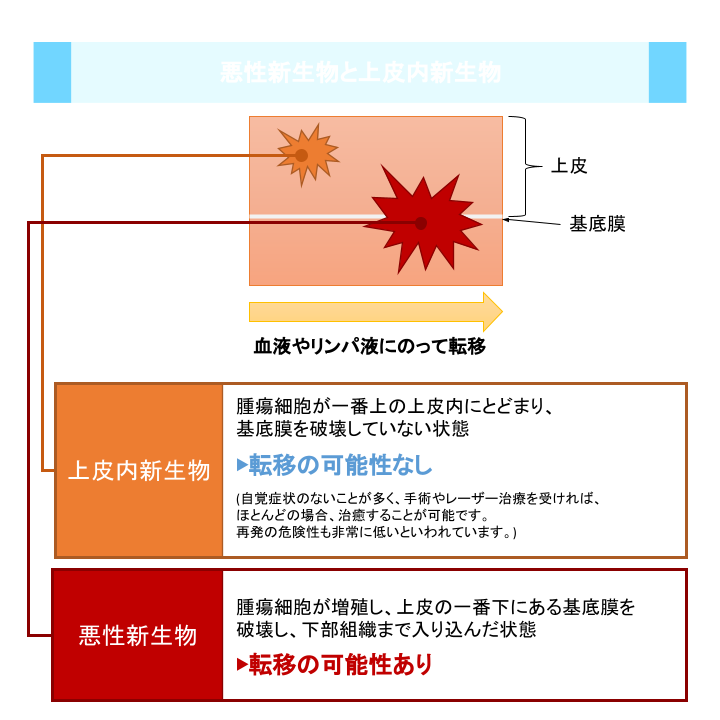 悪性新生物と上皮内新生物